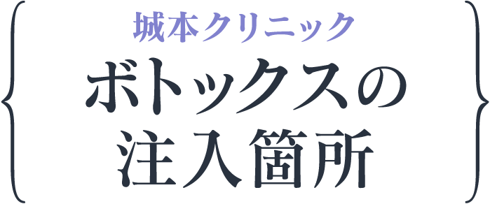 城本クリニック ボトックスの注入箇所
