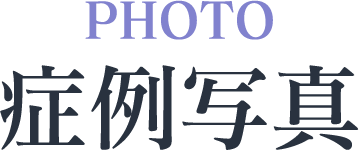 症例写真