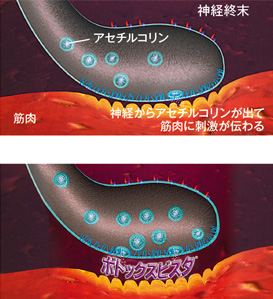 ボトックスビスタはどのようにして効くのか?