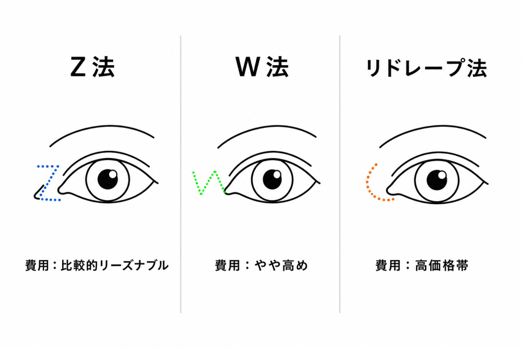 術式(Z法・リドレープ法・W法)による費用の違い