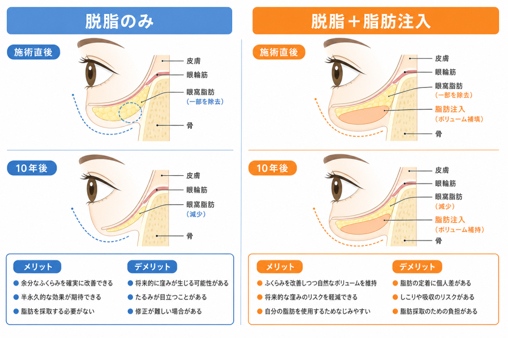 脱脂のみと脂肪注入併用で10年後の仕上がりが変わる