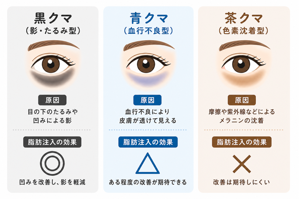 たるみ・小じわが悪化して見えるケース