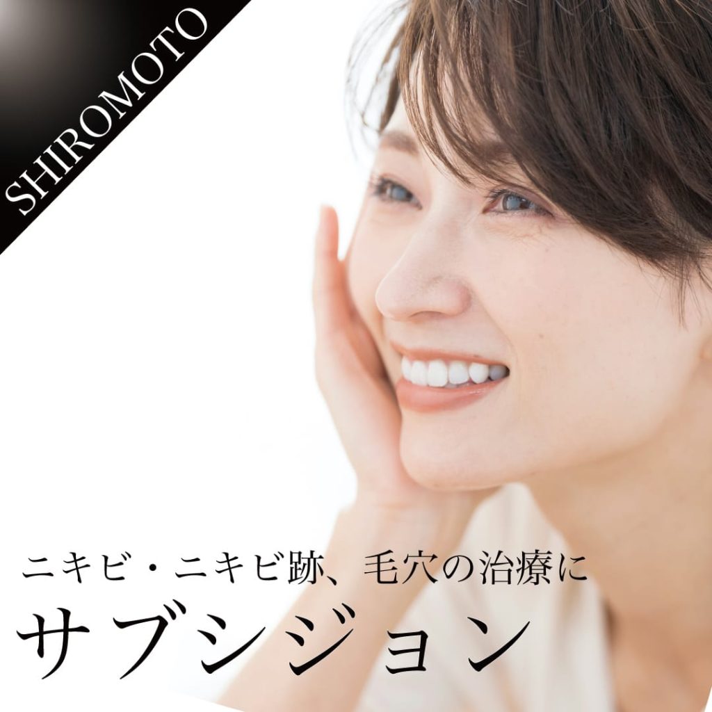 サブシジョン