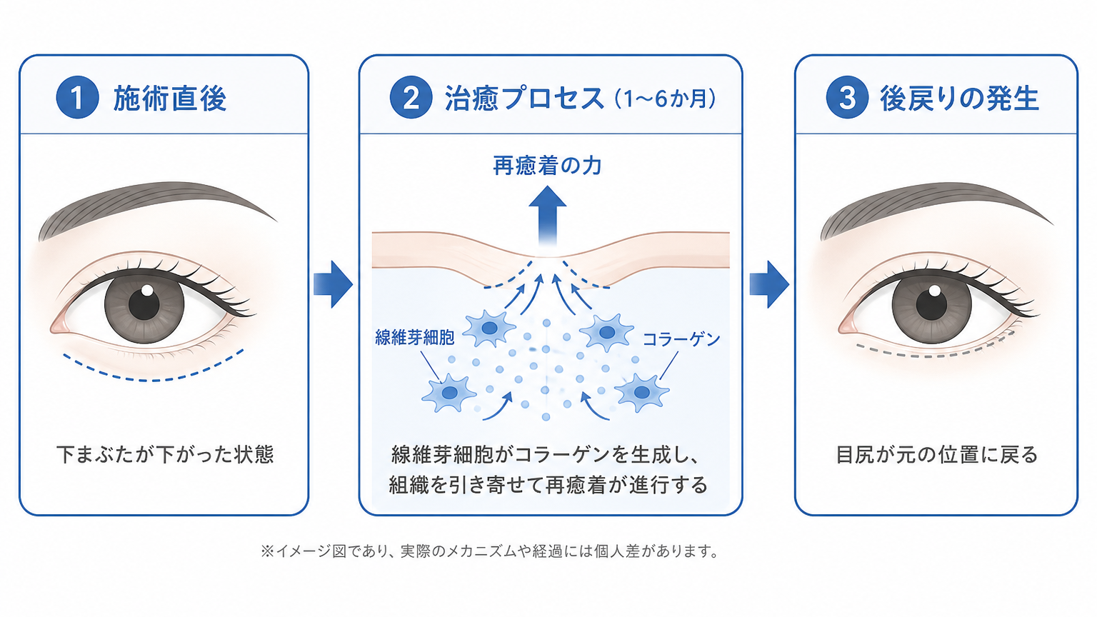 創傷治癒による組織の再癒着