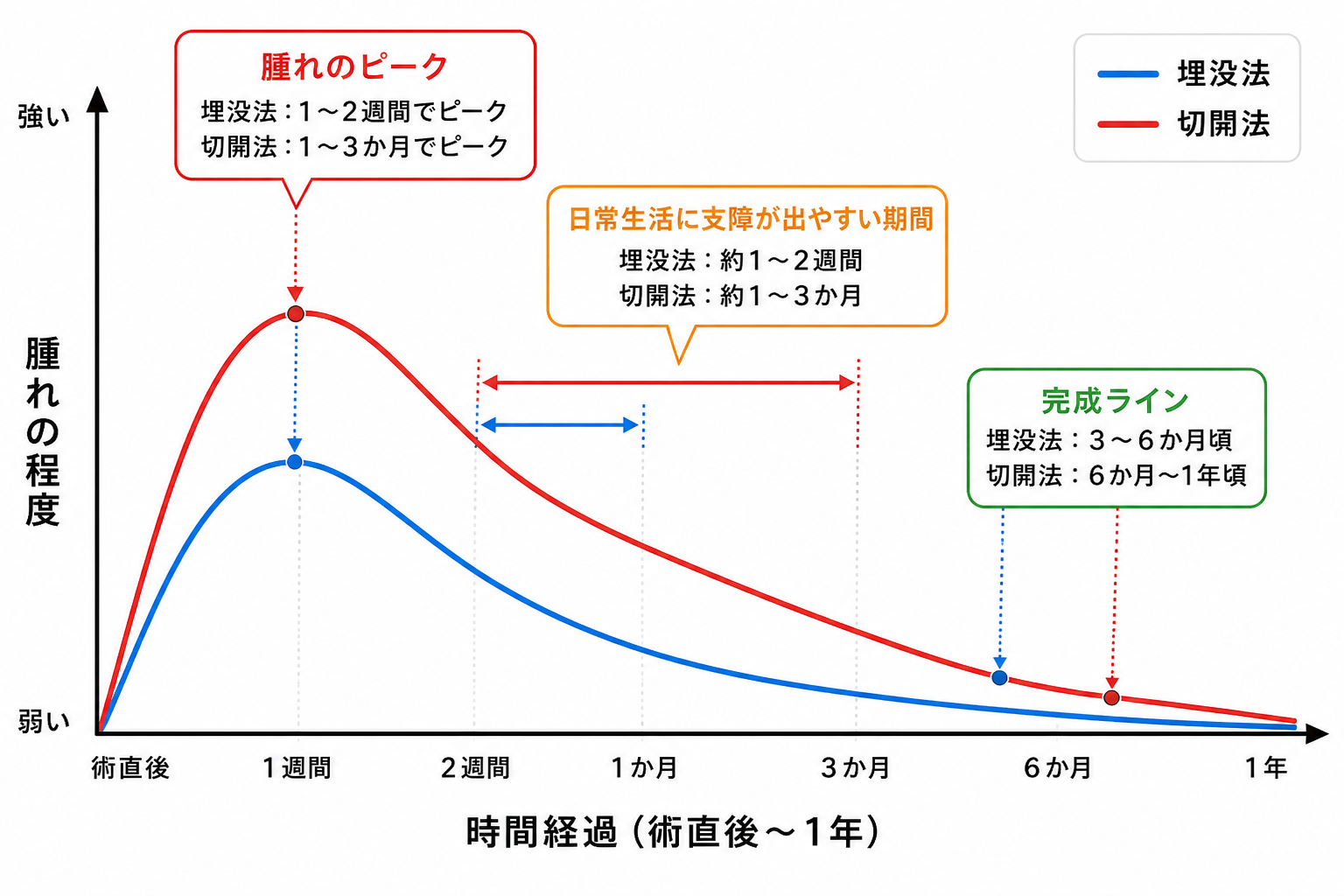 埋没法と切開法でダウンタイムの長さが異なる