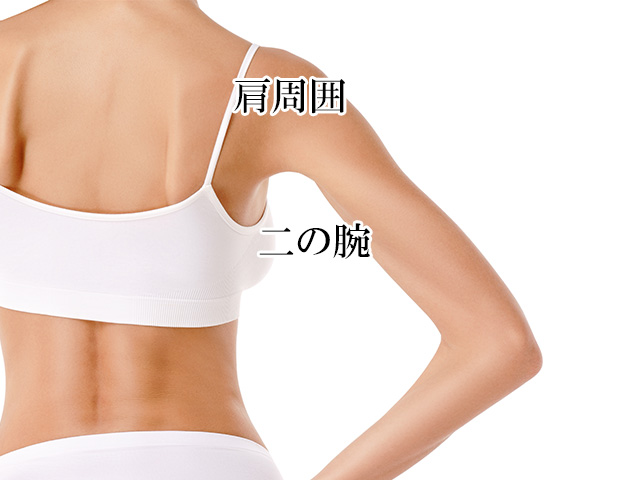 二の腕の脂肪吸引