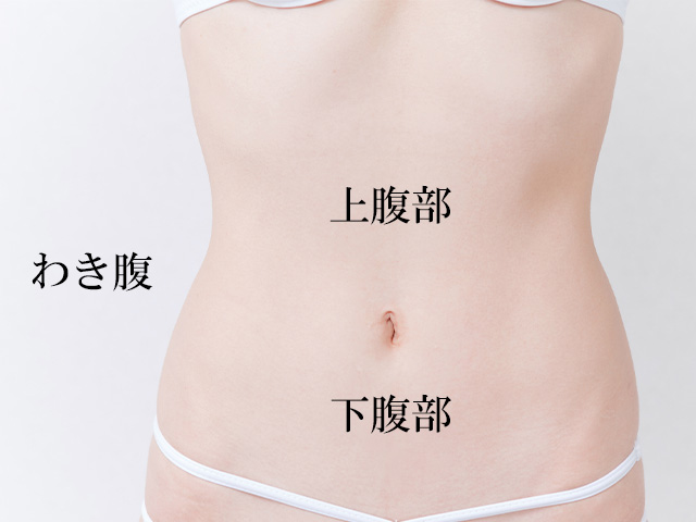 お腹の脂肪吸引