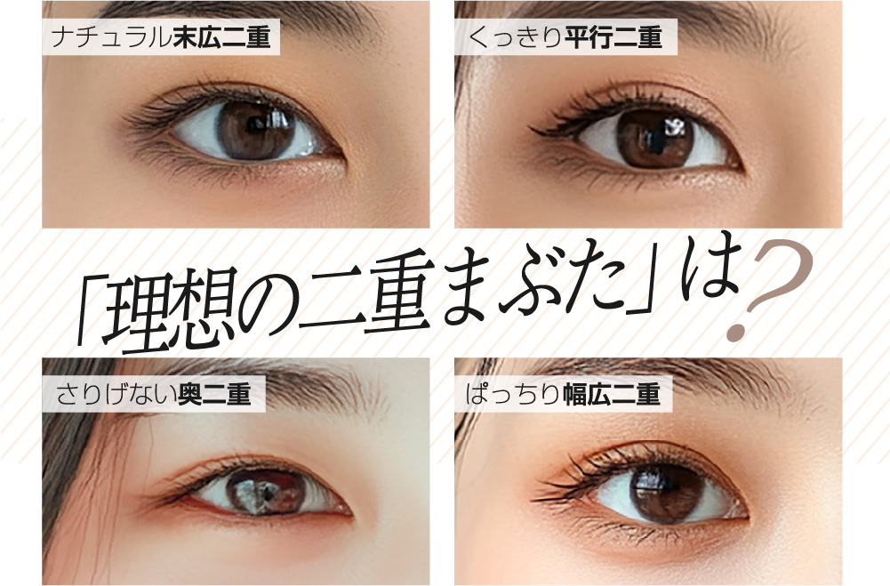 「理想の二重まぶた」は?